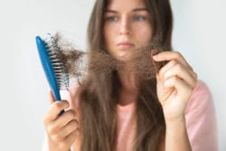 hair loss in women philadelphia